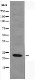 NDUFB9 Antibody