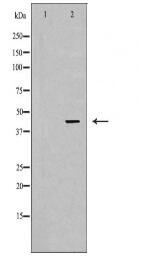 NKX2-1 Antibody