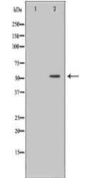 MMP11 Antibody