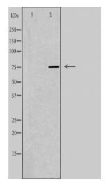 SLCO1B1 Antibody
