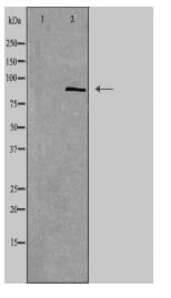 SMO Antibody