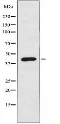 PPM1K Antibody