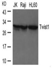 Twist1 Antibody