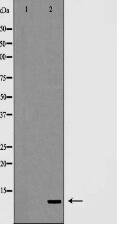 Insulin Antibody