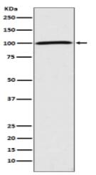 Sodium Potassium ATPase Antibody