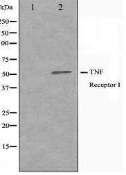 TNFR1 Antibody