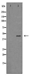 SERPINB3 Antibody