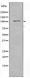 TAOK3 Antibody
