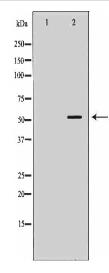 STEAP3 Antibody