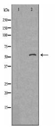 SERPING1 Antibody