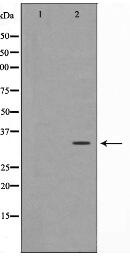 MAGE-1 Antibody