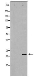 NUDT1 Antibody