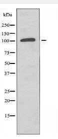 SUPT16H Antibody