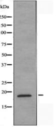 Myelodysplasia Syndrome 1 Antibody