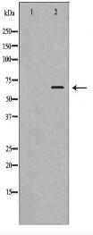 OPTN Antibody