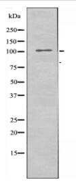 NCAPG Antibody