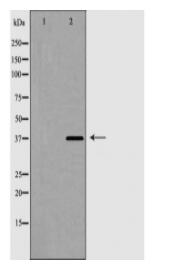 hnRPD Antibody