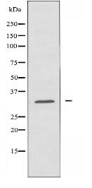 SLC25A6 Antibody