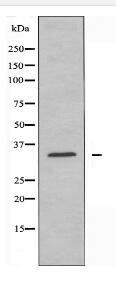 YOD1 Antibody
