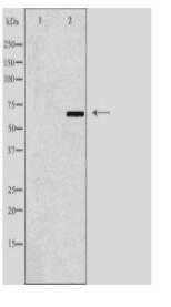 N4BP2L2 Antibody