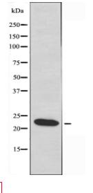NDUFB10 Antibody