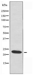 SCN2B Antibody