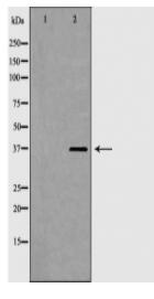 LDHA Antibody