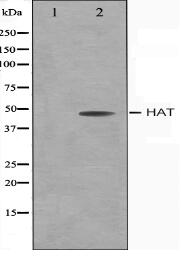 HAT Antibody
