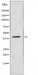 NT5C1A Antibody