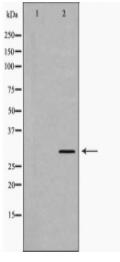 KLK3 Antibody