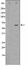 SLC27A2 Antibody