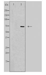 SLC5A2 Antibody