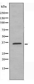 SRY Antibody