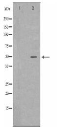 SGK1 Antibody
