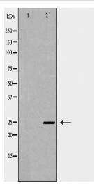 SOCS3 Antibody