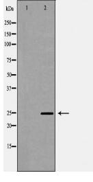 SIGMAR1 Antibody