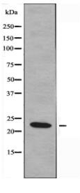 NDUFA8 Antibody