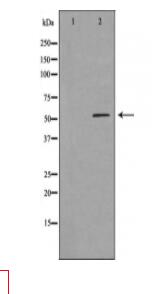 LBP Antibody