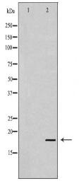 SKP1 Antibody