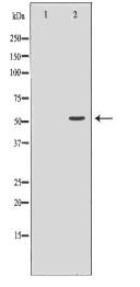 SLC18A2 Antibody