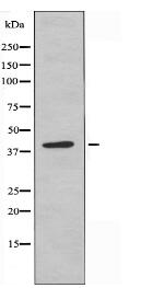 SERPINB9 Antibody