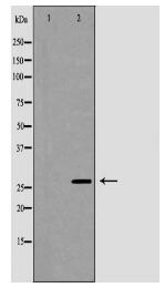 VAPB Antibody