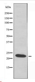 LDOC1L Antibody