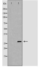 SFRS1 Antibody