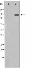 P Glycoprotein 1(MDR1) Antibody