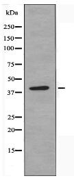 SH3GL2 Antibody