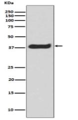 Phospho-LAT (Y191) Antibody