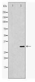 SLC25A4 Antibody