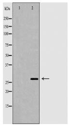 SFN Antibody
