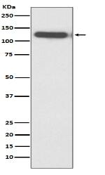 HDAC5 Antibody